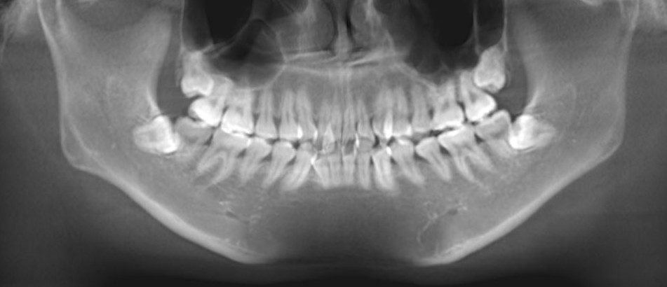 顎のずれの治し方と６つの必要な検査 横浜市星川の矯正歯科 ゆうデンタルオフィス